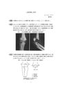 《上腕骨顆上骨折》