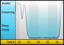 My sleep pattern